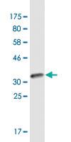 Anti-CARD17 Mouse Monoclonal Antibody [clone: 1G6]