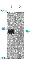 Anti-ACTA2 Rabbit Polyclonal Antibody