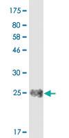 Anti-CD40 Mouse Monoclonal Antibody [clone: 5F2]