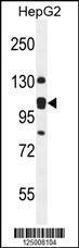 Anti-K0090 Rabbit Polyclonal Antibody (AP (Alkaline Phosphatase))