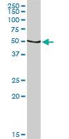 Anti-CALR Rabbit Polyclonal Antibody