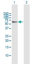 Anti-FGL2 Rabbit Polyclonal Antibody