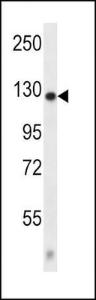 Anti-CACNA2D2 Rabbit Polyclonal Antibody (APC (Allophycocyanin))