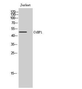 Western blot analysis of Jurkat cells using Anti-CtBP1 Antibody