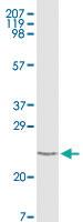 Anti-TNNI3 Mouse Monoclonal Antibody [clone: 3A10A12, 5C3A7]