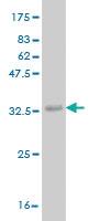 Anti-ADCK4 Mouse Monoclonal Antibody [clone: 1D9]