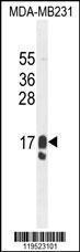 Anti-PIP Rabbit Polyclonal Antibody (PE (Phycoerythrin))