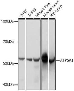 Anti-ATP5A Rabbit Monoclonal Antibody [clone: ARC0549]