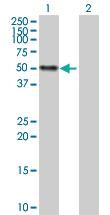 Anti-CALR Rabbit Polyclonal Antibody