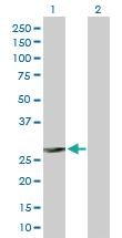 Anti-FCER1A Rabbit Polyclonal Antibody