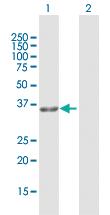 Anti-GPD1L Rabbit Polyclonal Antibody