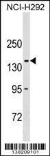 Anti-COL20A1 Rabbit Polyclonal Antibody (AP (Alkaline Phosphatase))