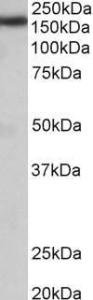 Anti-Zcchc11 Antibody (A84989) (005 µg/ml) staining of Rat Brain lysate (35 µg protein in RIPA buffer) Primary incubation was 1 hour Detected by chemiluminescence