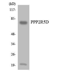 Western blot analysis of the lysates from HUVEC cells using Anti-PPP2R5D Antibody