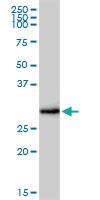 Anti-FCER1A Rabbit Polyclonal Antibody