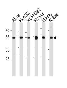 Anti-ALDH2 Rabbit Polyclonal Antibody (APC (Allophycocyanin))