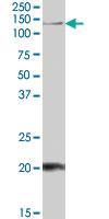 Anti-HTATSF1 Goat Polyclonal Antibody