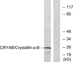 Anti-Alpha B Crystallin Rabbit Polyclonal Antibody