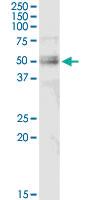 Anti-FGL2 Rabbit Polyclonal Antibody