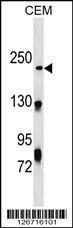 Anti-NHSL1 Rabbit Polyclonal Antibody (Biotin)