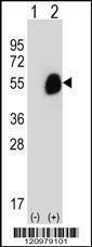 Anti-GCDH Rabbit Polyclonal Antibody (APC (Allophycocyanin))