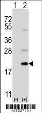 Anti-UFC1 Rabbit Polyclonal Antibody (HRP (Horseradish Peroxidase))