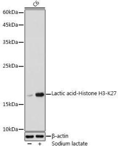 Western blot analysis of extracts of C6 cells, using Anti-Histone H3 (lactyl Lys27) Antibody (A305265) at 1:1000 dilution