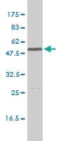 Anti-CALR Mouse Monoclonal Antibody [clone: 1G11-1A9]