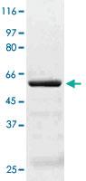 Anti-AKT3 Rabbit Polyclonal Antibody