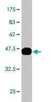 Anti-KLK10 Mouse Monoclonal Antibody [clone: 1G8]