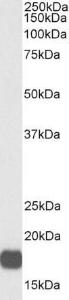 Anti-VHL antibody