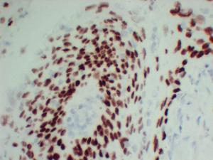 Anti-p63 Protein + HMW Cytokeratin Mouse Monoclonal Antibody [clone: ABT-P40]