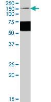 Anti-GRIK1 Goat Polyclonal Antibody