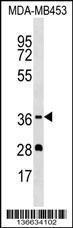 Anti-OR5M1 Rabbit Polyclonal Antibody (AP (Alkaline Phosphatase))