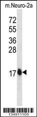 Anti-GABARAPL2 Rabbit Polyclonal Antibody (AP (Alkaline Phosphatase))