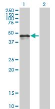 Anti-CALR Mouse Monoclonal Antibody [clone: 1G11-1A9]