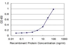 Anti-NEU2 Mouse Monoclonal Antibody [clone: 2E5]