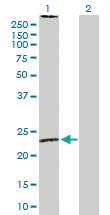 Anti-MS4A2 Rabbit Polyclonal Antibody