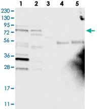 Anti-CFAP74 Rabbit Polyclonal Antibody