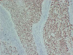 Anti-p63 Protein + HMW Cytokeratin Mouse Monoclonal Antibody [clone: ABT-P40]