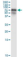 Anti-FGL2 Rabbit Polyclonal Antibody