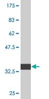 Anti-ALOX15B Mouse Monoclonal Antibody [clone: 4A7]