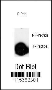 Anti-LINGO Rabbit Polyclonal Antibody (HRP (Horseradish Peroxidase))