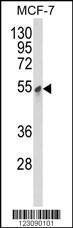 Anti-Pyruvate Dehydrogenase Kinase Isoform 3 Rabbit Polyclonal Antibody (PE (Phycoerythrin))