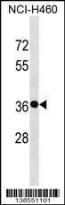 Anti-GSX2 Rabbit Polyclonal Antibody (FITC (Fluorescein Isothiocyanate))