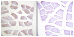 Anti-Alpha B Crystallin Rabbit Polyclonal Antibody