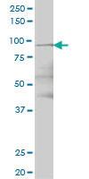 Anti-TTK Mouse Monoclonal Antibody [clone: 2F1]