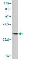 Anti-GNPDA1 Mouse Polyclonal Antibody