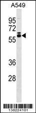 Anti-DUS2 Rabbit Polyclonal Antibody (APC (Allophycocyanin))