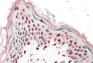 Anti-SRCAP Antibody (A84991) (5 µg/ml) staining of paraffin embedded Human Skin. Steamed antigen retrieval with citrate buffer pH 6, AP-staining